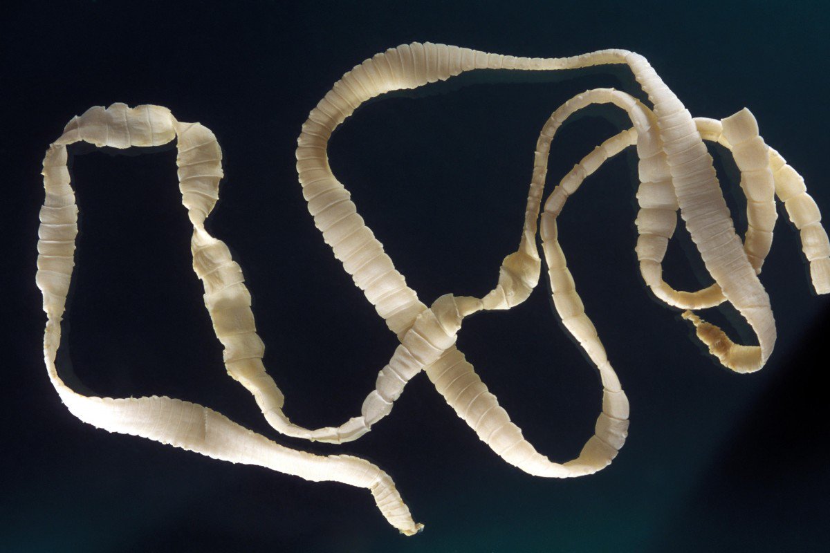 flat worms in humans